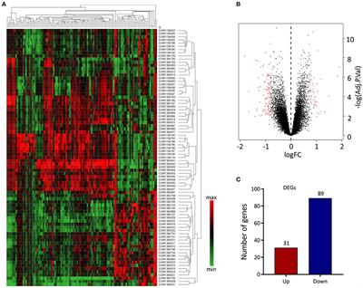 Bioinformatics Analysis Reveals the Potential Diagnostic Biomarkers for Abdominal Aortic Aneurysm